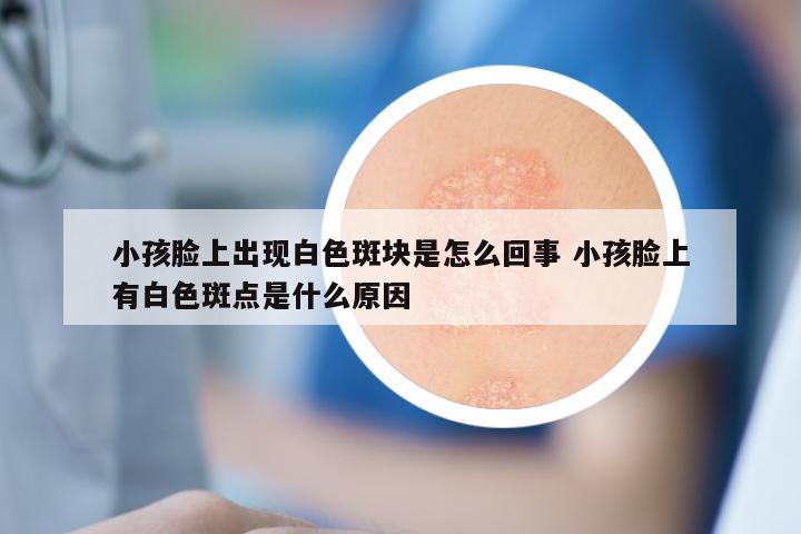 小孩脸上出现白色斑块是怎么回事 小孩脸上有白色斑点是什么原因