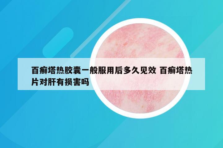 百癣塔热胶囊一般服用后多久见效 百癣塔热片对肝有损害吗