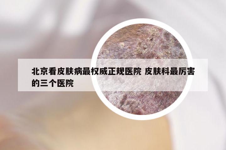 北京看皮肤病最权威正规医院 皮肤科最厉害的三个医院