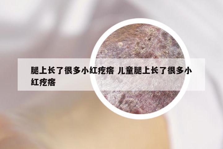 腿上长了很多小红疙瘩 儿童腿上长了很多小红疙瘩