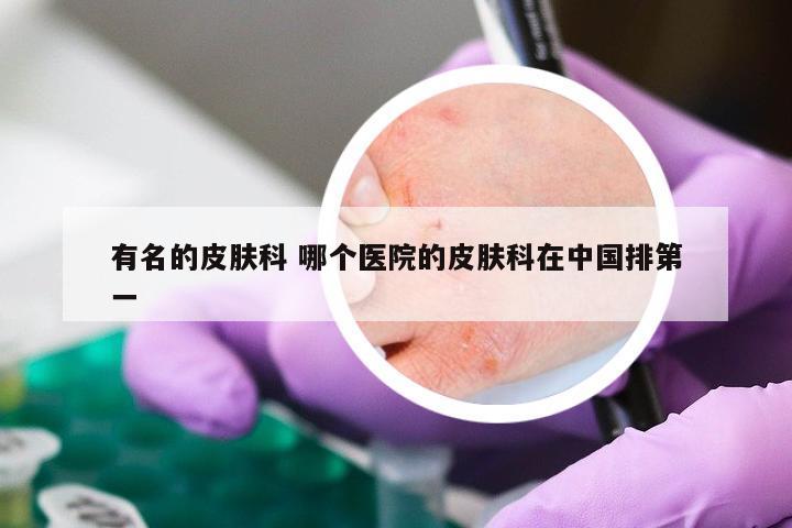 有名的皮肤科 哪个医院的皮肤科在中国排第一