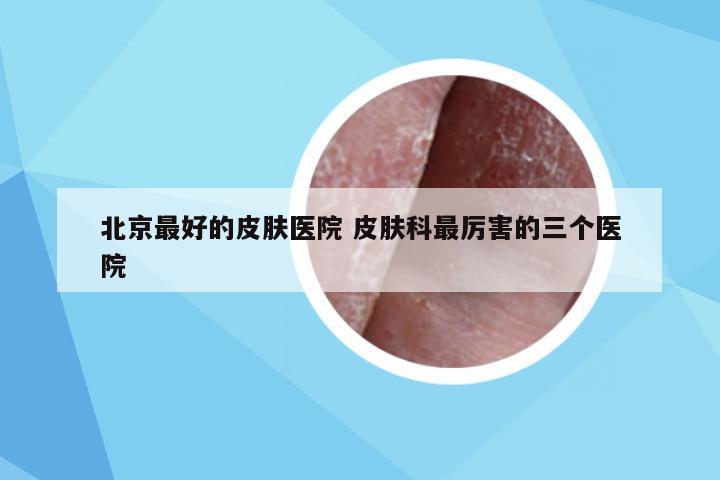 北京最好的皮肤医院 皮肤科最厉害的三个医院