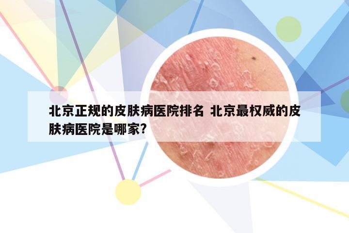 北京正规的皮肤病医院排名 北京最权威的皮肤病医院是哪家?