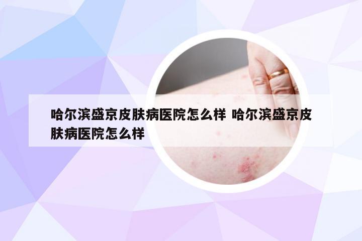 哈尔滨盛京皮肤病医院怎么样 哈尔滨盛京皮肤病医院怎么样