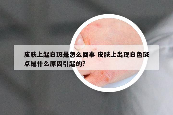 皮肤上起白斑是怎么回事 皮肤上出现白色斑点是什么原因引起的?