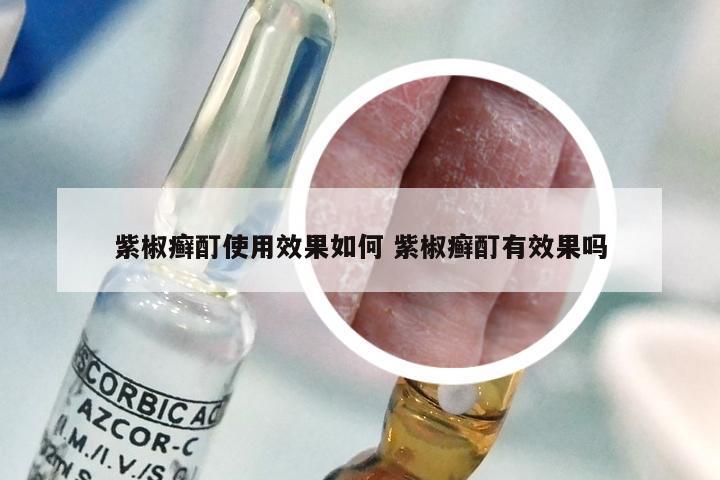 紫椒癣酊使用效果如何 紫椒癣酊有效果吗