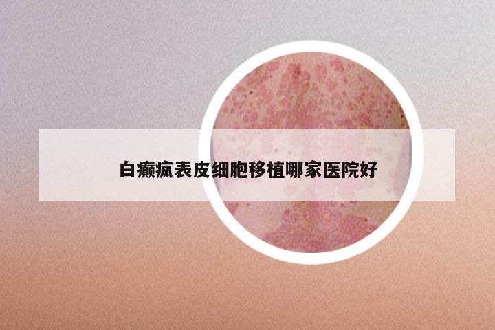 白癫疯表皮细胞移植哪家医院好