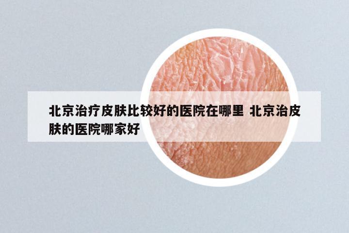 北京治疗皮肤比较好的医院在哪里 北京治皮肤的医院哪家好