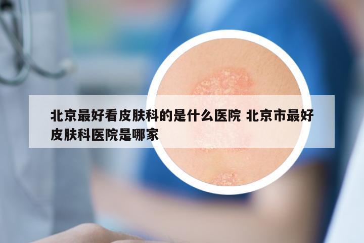 北京最好看皮肤科的是什么医院 北京市最好皮肤科医院是哪家