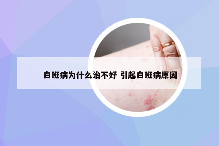 白班病为什么治不好 引起白班病原因