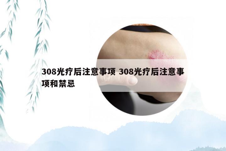 308光疗后注意事项 308光疗后注意事项和禁忌