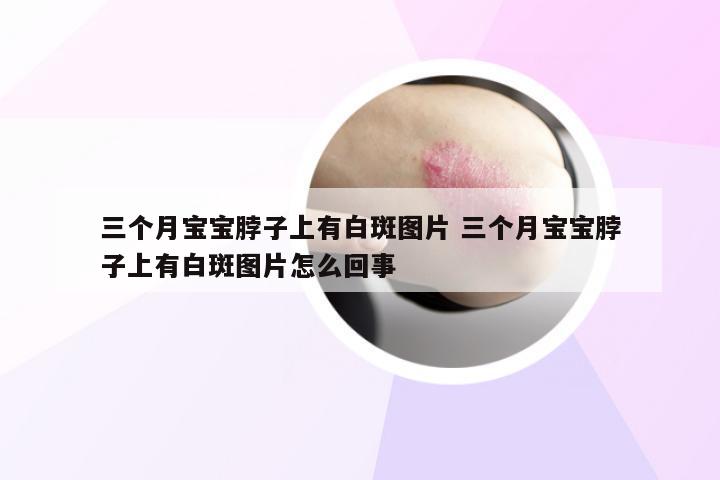 三个月宝宝脖子上有白斑图片 三个月宝宝脖子上有白斑图片怎么回事