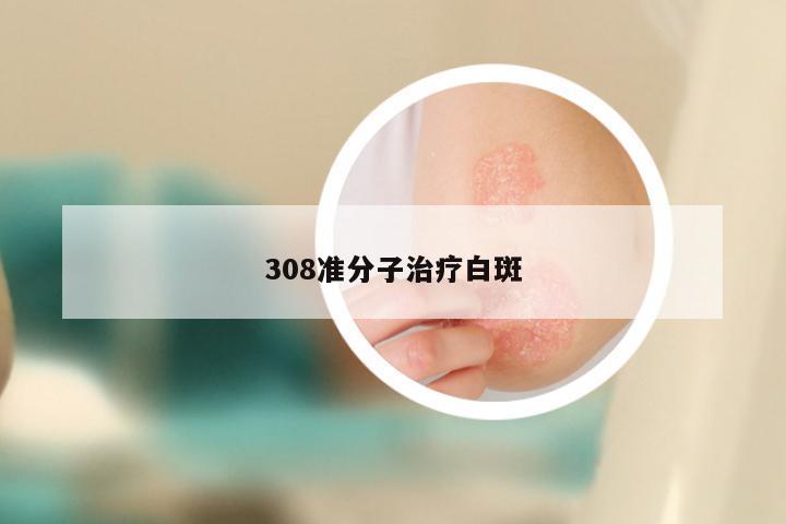 308准分子治疗白斑