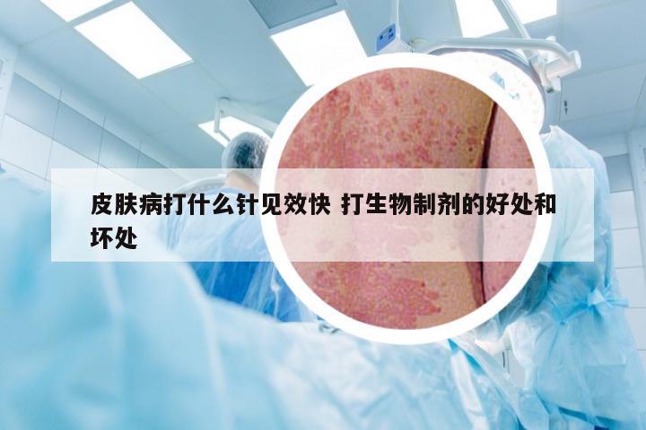 皮肤病打什么针见效快 打生物制剂的好处和坏处