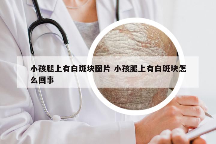 小孩腿上有白斑块图片 小孩腿上有白斑块怎么回事