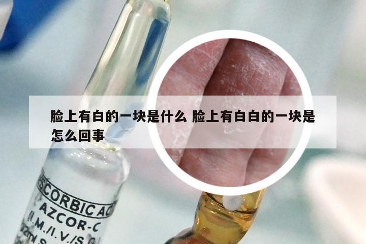 脸上有白的一块是什么 脸上有白白的一块是怎么回事