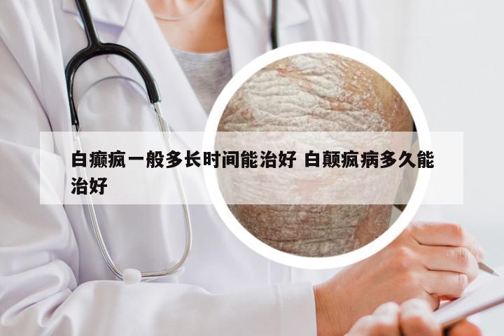 白癫疯一般多长时间能治好 白颠疯病多久能治好