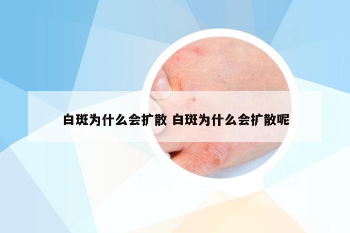 白斑为什么会扩散 白斑为什么会扩散呢