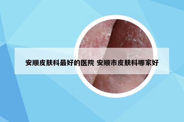 安顺皮肤科最好的医院 安顺市皮肤科哪家好