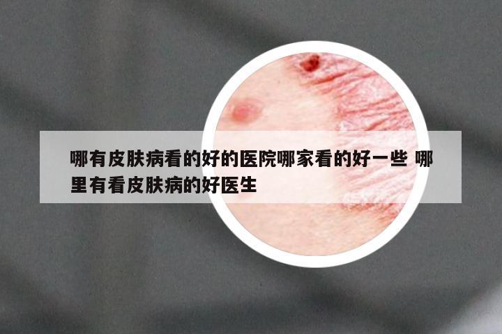 哪有皮肤病看的好的医院哪家看的好一些 哪里有看皮肤病的好医生
