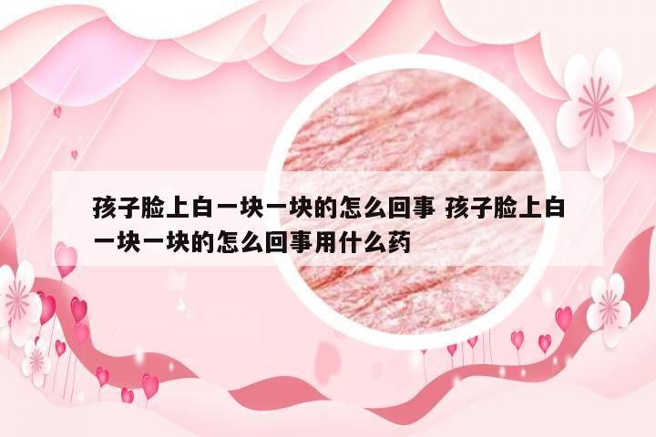 孩子脸上白一块一块的怎么回事 孩子脸上白一块一块的怎么回事用什么药