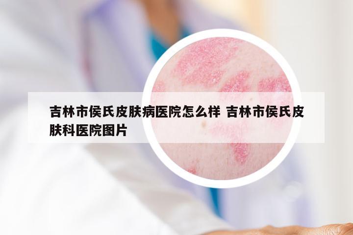 吉林市侯氏皮肤病医院怎么样 吉林市侯氏皮肤科医院图片