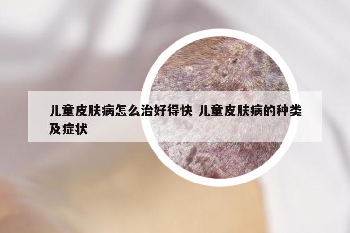 儿童皮肤病怎么治好得快 儿童皮肤病的种类及症状