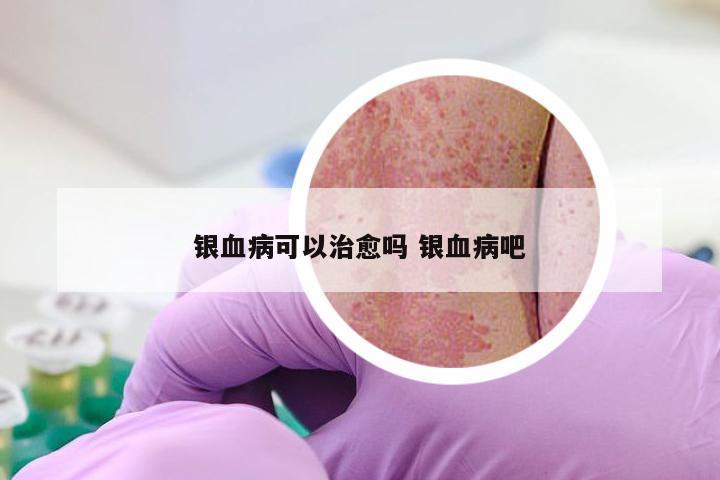 银血病可以治愈吗 银血病吧