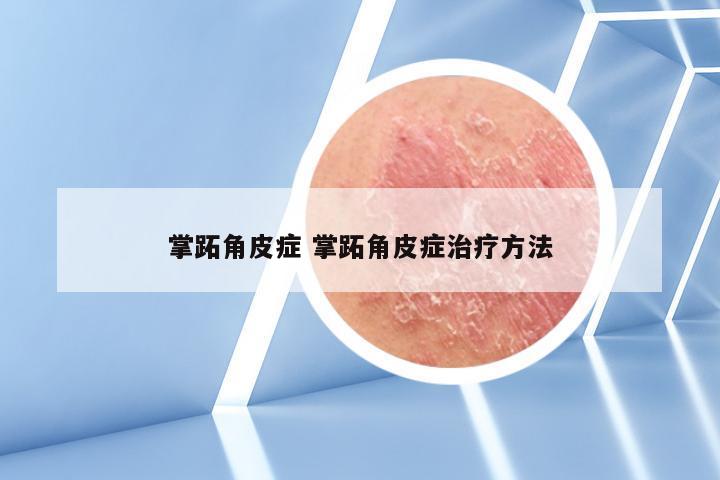 掌跖角皮症 掌跖角皮症治疗方法
