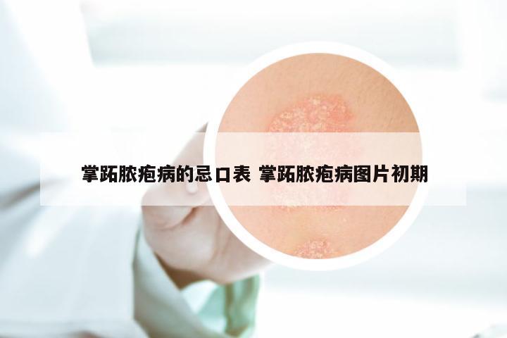 掌跖脓疱病的忌口表 掌跖脓疱病图片初期