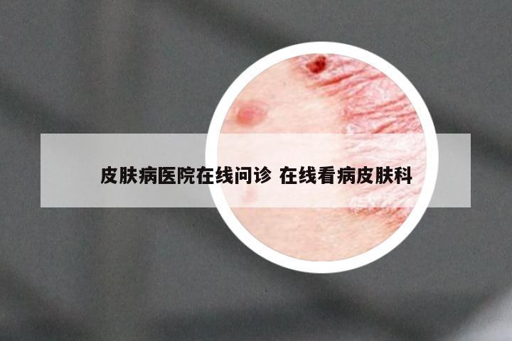 皮肤病医院在线问诊 在线看病皮肤科