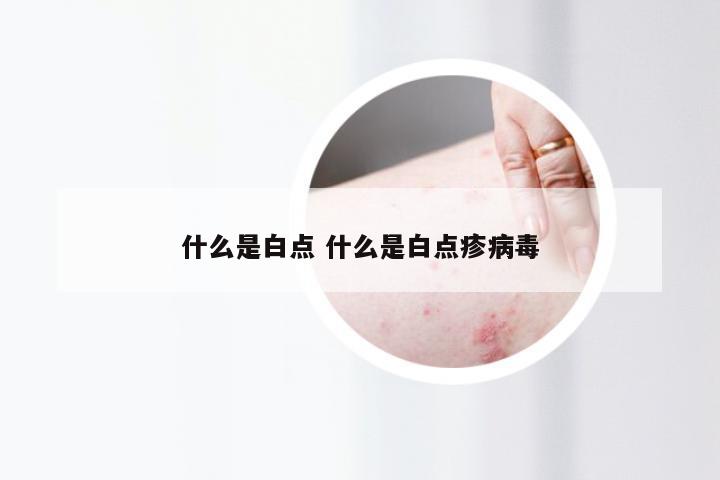 什么是白点 什么是白点疹病毒