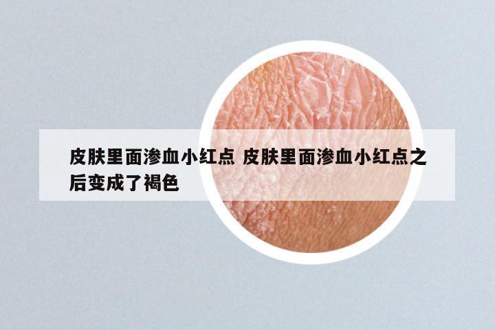 皮肤里面渗血小红点 皮肤里面渗血小红点之后变成了褐色