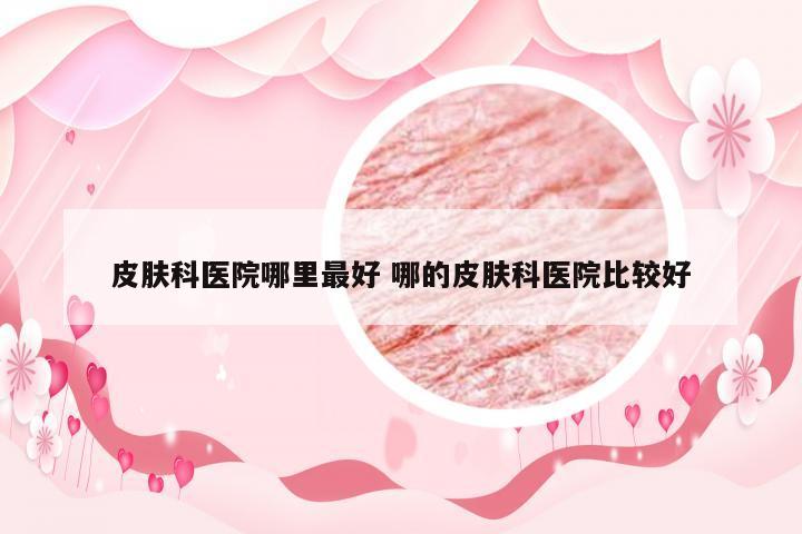 皮肤科医院哪里最好 哪的皮肤科医院比较好