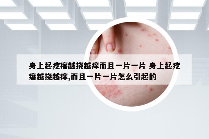 身上起疙瘩越挠越痒而且一片一片 身上起疙瘩越挠越痒,而且一片一片怎么引起的