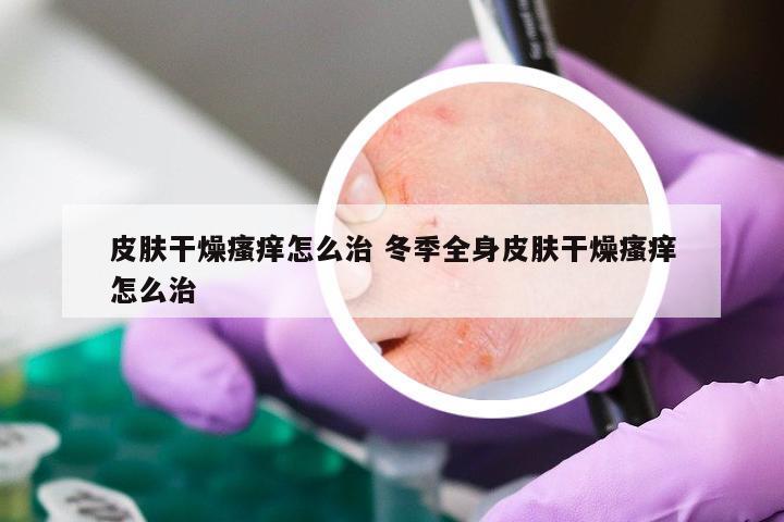 皮肤干燥瘙痒怎么治 冬季全身皮肤干燥瘙痒怎么治