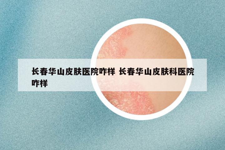 长春华山皮肤医院咋样 长春华山皮肤科医院咋样