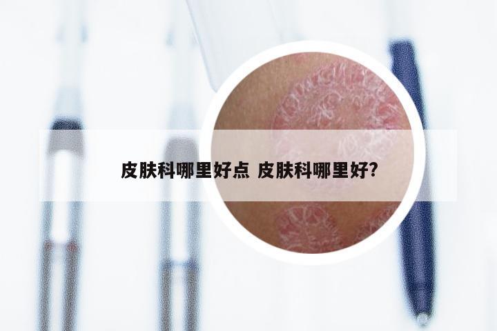 皮肤科哪里好点 皮肤科哪里好?