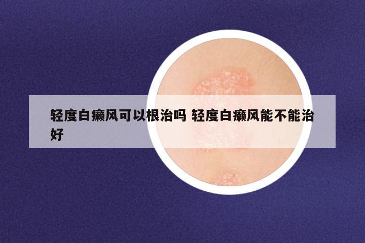 轻度白癞风可以根治吗 轻度白癞风能不能治好
