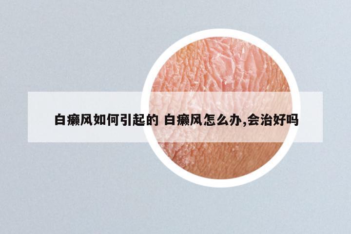 白癞风如何引起的 白癞风怎么办,会治好吗