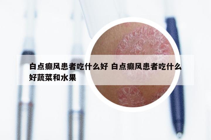 白点癫风患者吃什么好 白点癫风患者吃什么好蔬菜和水果