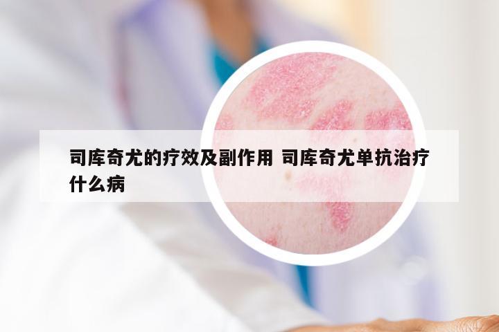 司库奇尤的疗效及副作用 司库奇尤单抗治疗什么病