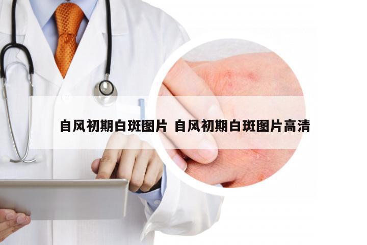 自风初期白斑图片 自风初期白斑图片高清