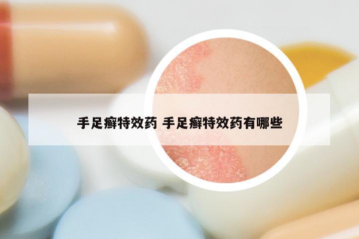 手足癣特效药 手足癣特效药有哪些