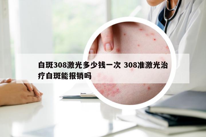 白斑308激光多少钱一次 308准激光治疗白斑能报销吗