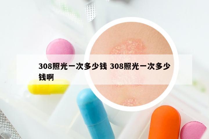 308照光一次多少钱 308照光一次多少钱啊