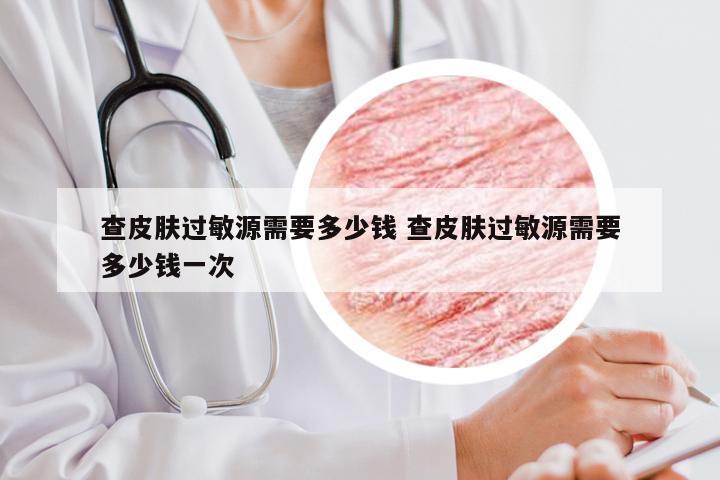 查皮肤过敏源需要多少钱 查皮肤过敏源需要多少钱一次