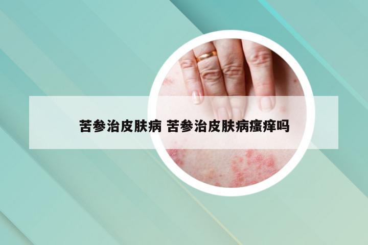 苦参治皮肤病 苦参治皮肤病瘙痒吗