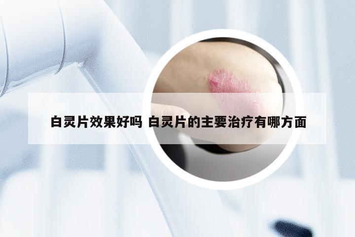 白灵片效果好吗 白灵片的主要治疗有哪方面