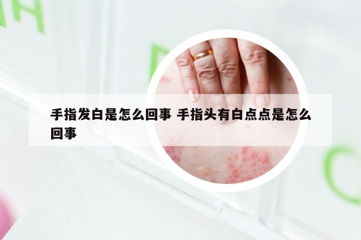 手指发白是怎么回事 手指头有白点点是怎么回事